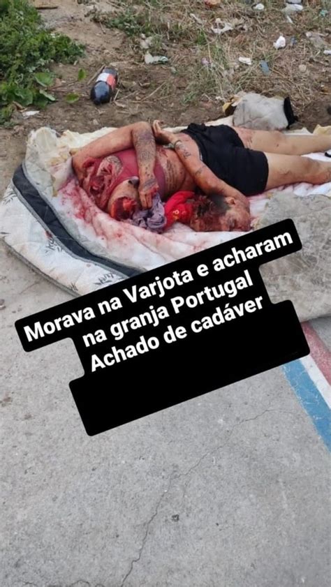 herdeaths.net|The woman had a leg amputated in an accident .